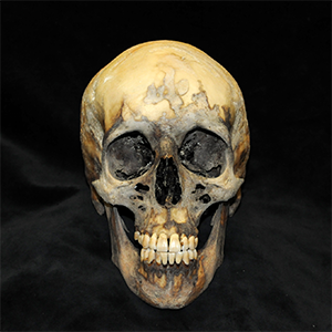 Holmes skull