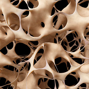 Struan F. Grant / 3D Genomics and Osteoporosis