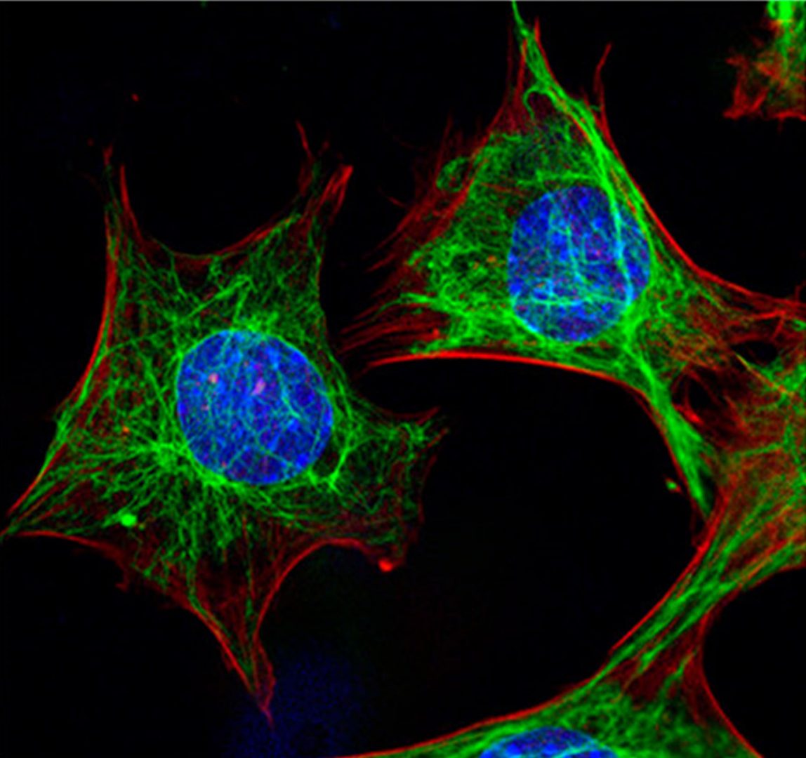 A fluorescent optical micrograph showing how vimentin networks (green) respond to compressive loads, and protect the cell nucleus from mechanical damage